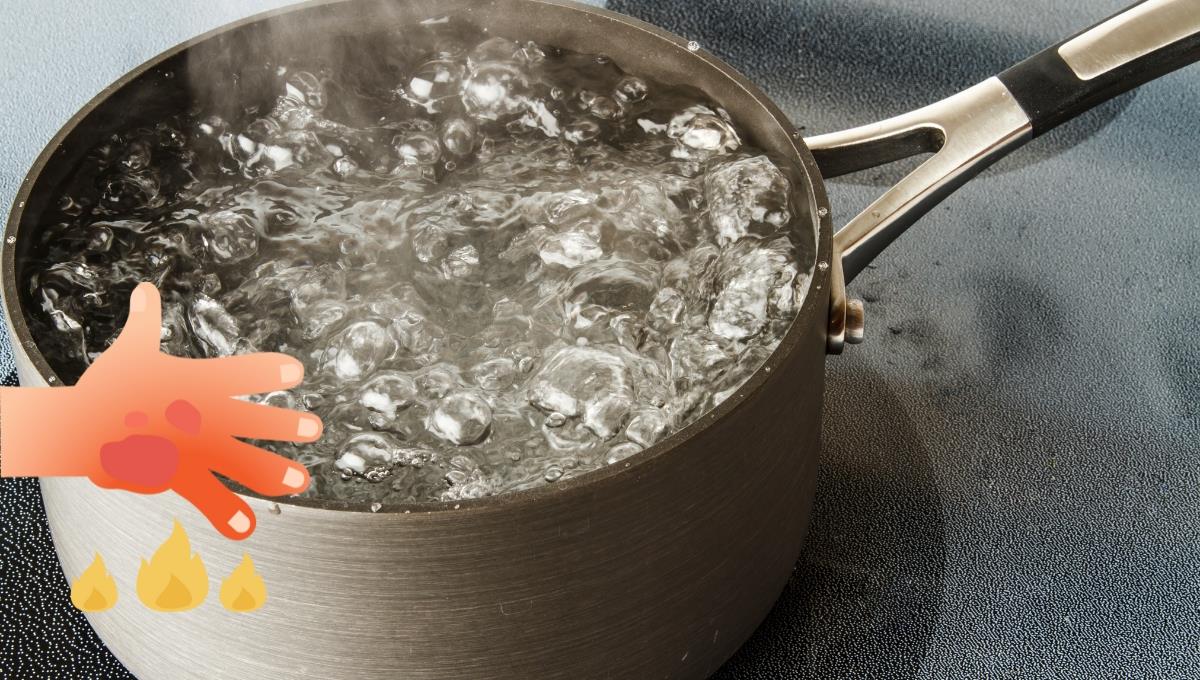 Paso a paso: qué hacer si te quemaste con agua hirviendo